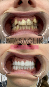 Dental Clinic Izmir