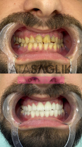 Dental Clinic Izmir