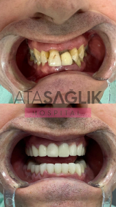 Dental Clinic Izmir