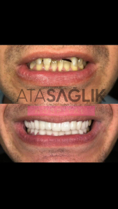 Dental Clinic Izmir