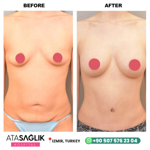 Aesthetic Plastic, Reconstructive Surgery