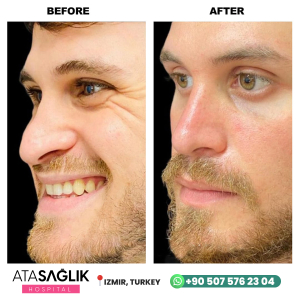 Aesthetic Plastic, Reconstructive Surgery