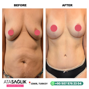 Aesthetic Plastic, Reconstructive Surgery