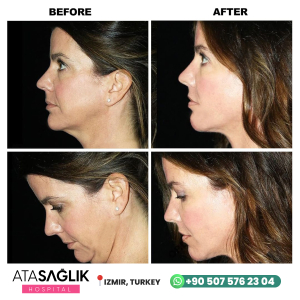 Aesthetic Plastic, Reconstructive Surgery