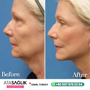 Aesthetic Plastic, Reconstructive Surgery