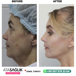 Aesthetic Plastic, Reconstructive Surgery