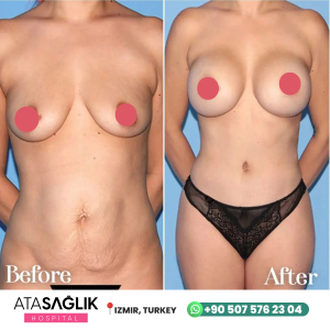 Aesthetic Plastic, Reconstructive Surgery